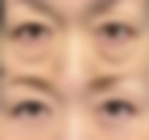 七、昆明婕熹卡整形医疗美容门诊部真实的顾客评价如下: