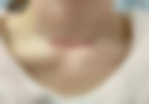 六、台州温岭医美佳医疗美容诊所怎么预约:
