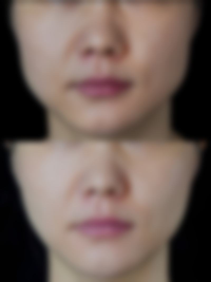 四、昆明婕熹卡整形医疗美容门诊部实例