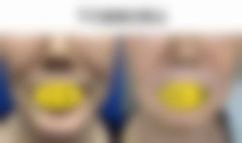 八、南京宁尔美医疗美容诊所真实的顾客评价如下: