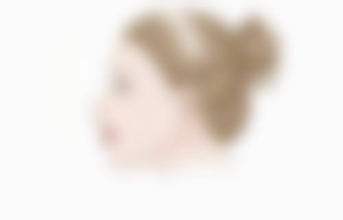 做双眼皮后消肿:促愈合药膏加速修复