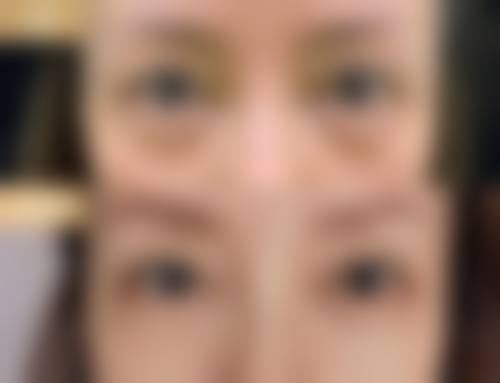 五、航天七三一医院(皮肤整形外科)实例