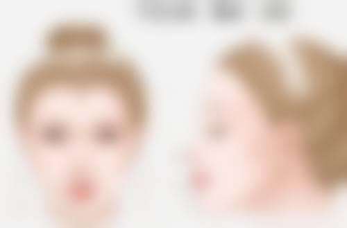 小腿肚抽脂:成效咋样能维持多久?