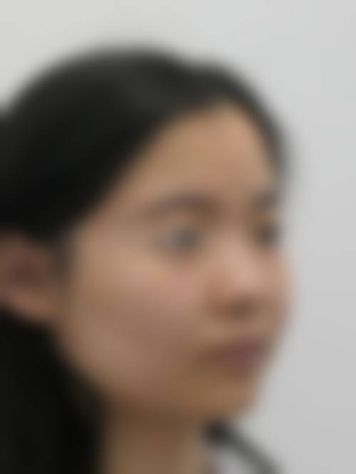 七、成都菲思丽致整形医院真实的顾客评价如下: