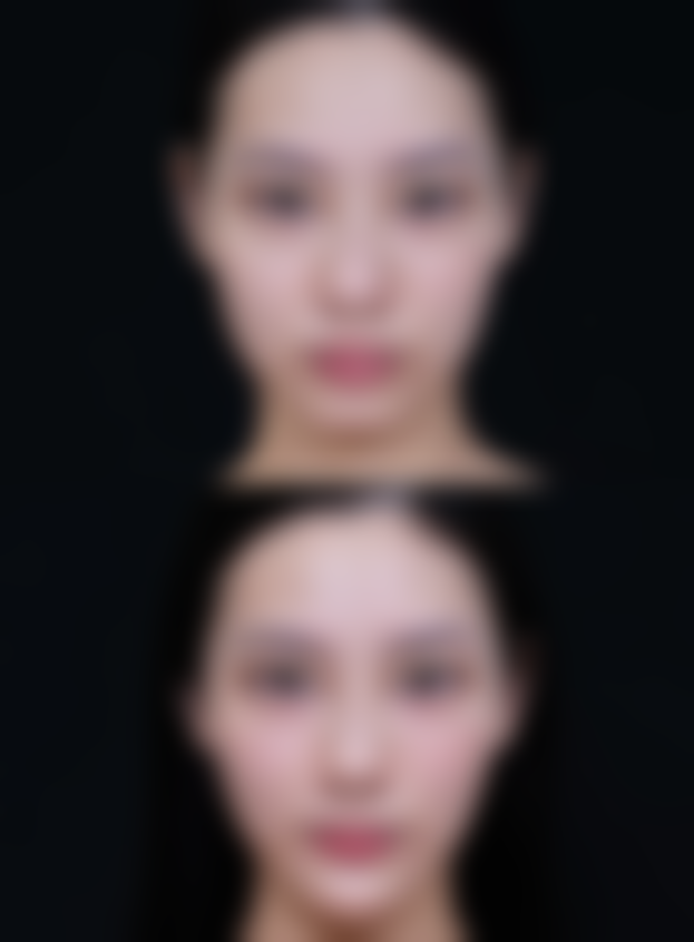 想让单眼皮秒变双眼皮？多种方式任你选，术后快速恢复，效果持久自然！ 