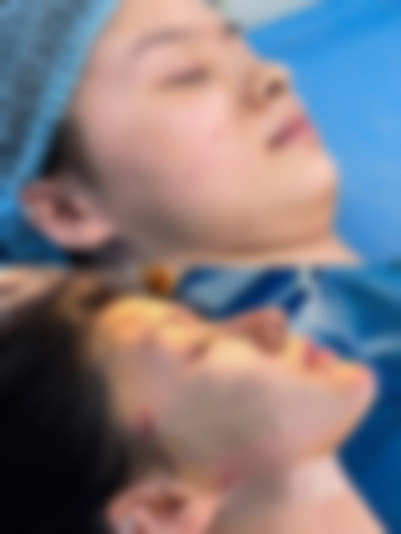八、巴州奥蕊斯医疗美容门诊部真实的顾客评价如下: