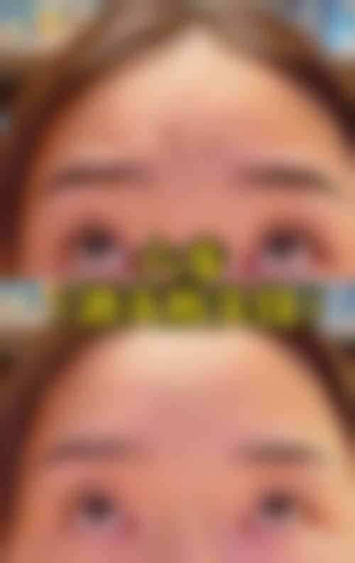 五、东营创颜美整形医院实例