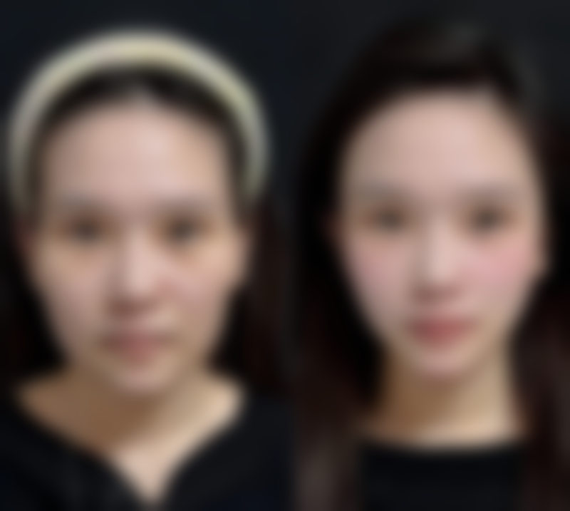 四、表参道Skin 广岛开展的主要项目和特色项目: