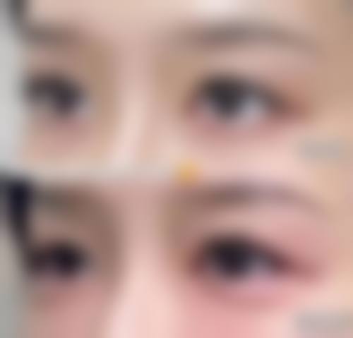 六、南宁瑞柏美医疗美容门诊部怎么预约: