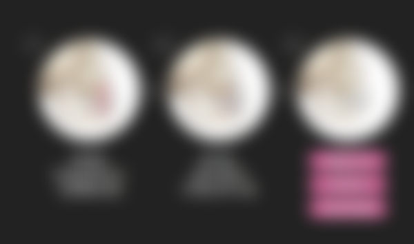 术后修复:轻松拥有妈生感灵动眼型
