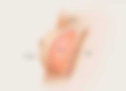 巧妙改善缝针疤痕外观：物理治疗来帮忙