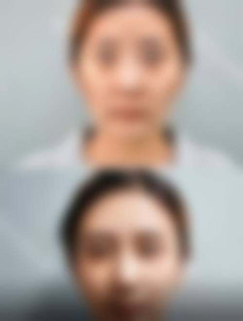 二、温州壹美整形医院正规吗?来看看医院资质: