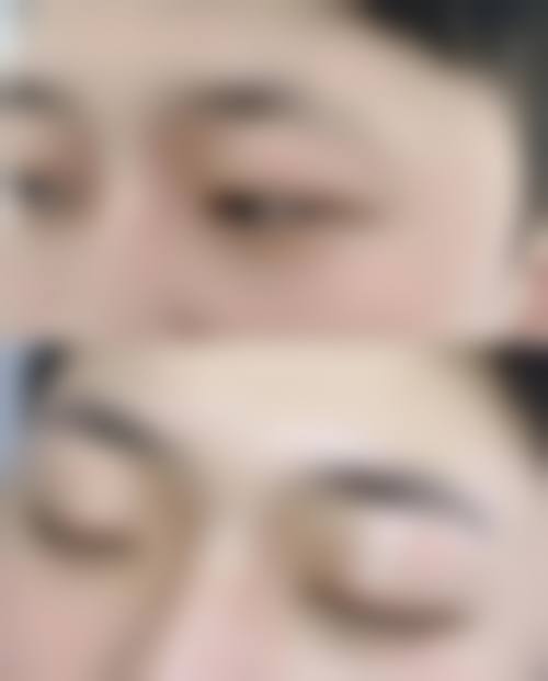 三、厦门碧莲盛无痕植发整形医生介绍:
