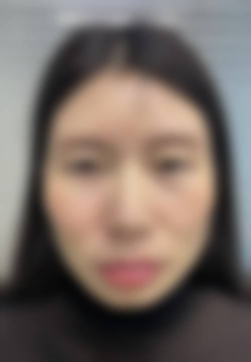 五、绍兴华美整形美容医院实例