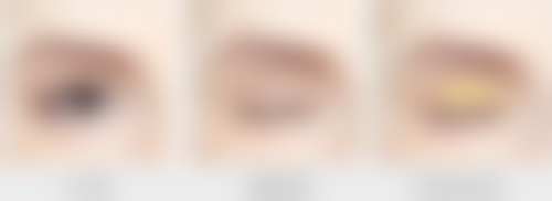俞锡娟医生怎么样可靠吗？