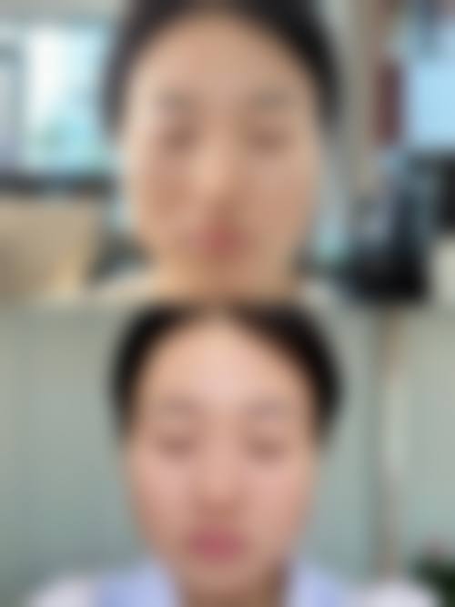 六、宁波美苑医疗美容医院怎么预约：
