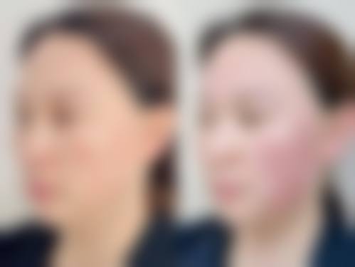六、海口嘉美医学美容门诊部怎么预约：
