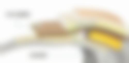 三点定位双眼皮能坚持多久?术后护理与生活习惯作用大