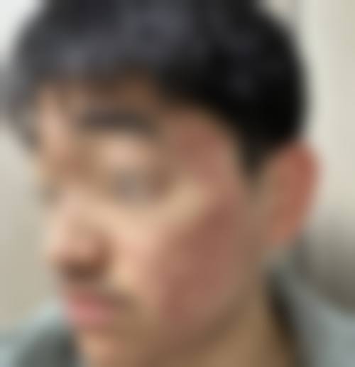 顾礼忠医生怎么样可靠吗?