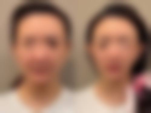 七、北京善美医疗美容医院价格表:(仅供参考)