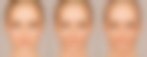 割完双眼皮拆线后,瘢痕体质/愈合不良时何时能洗脸?
